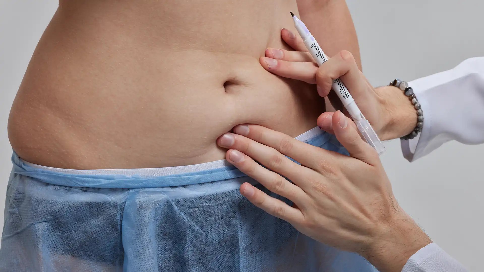 ARSA - PRMA - Web Page – Tummy Tuck_-optimized