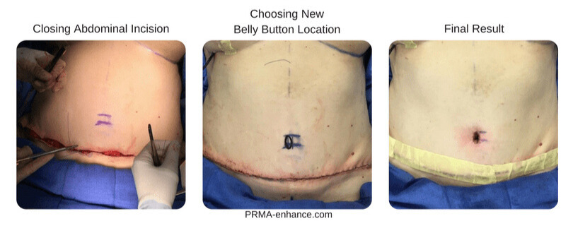 belly button recreation - Edited