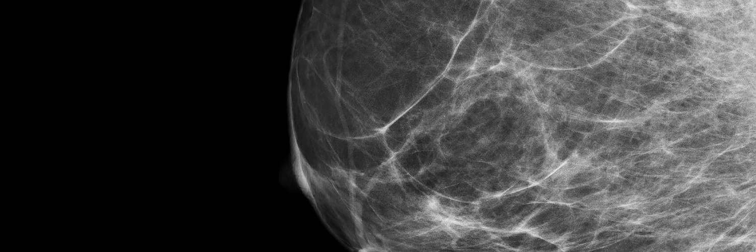 Google's New Breast Cancer Screening Technology PRMA Plastic Surgery