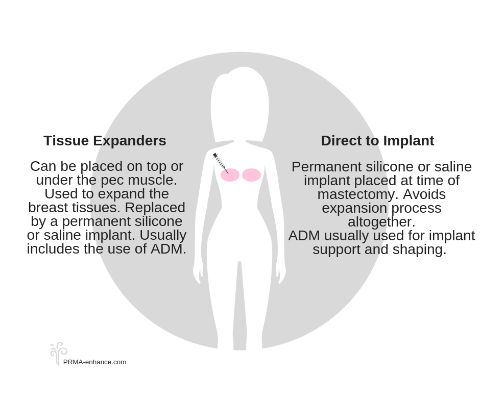 Implant_breast_reconstruction_options_prma