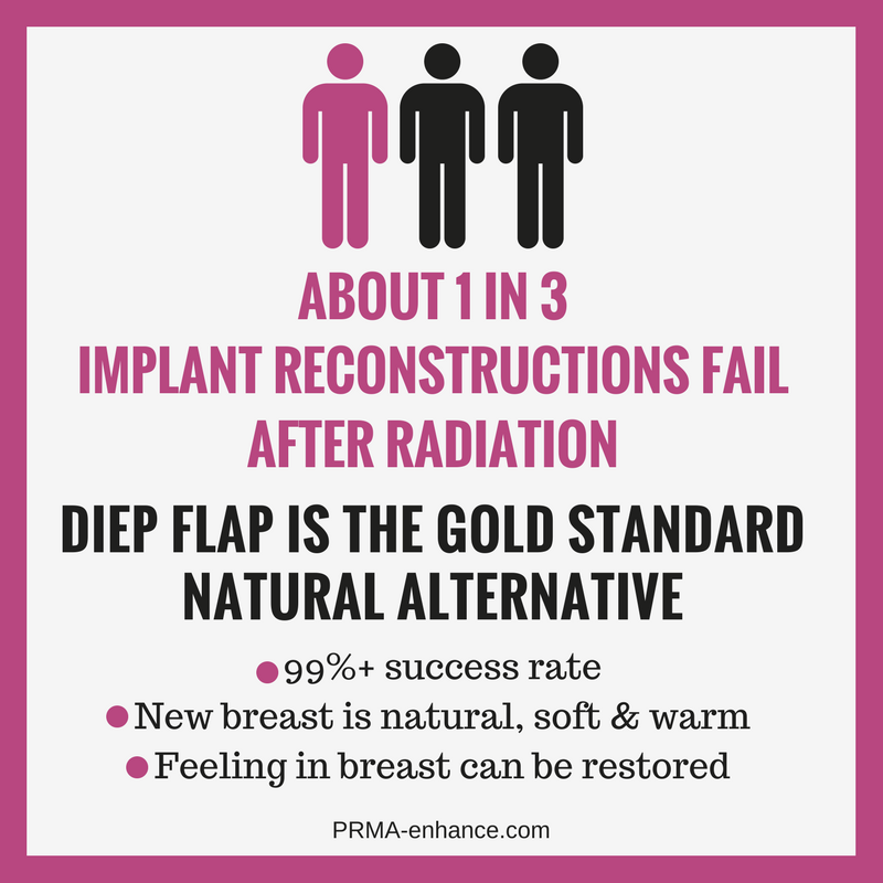 implant breast reconstruction failure after radiation prma plastic surgery