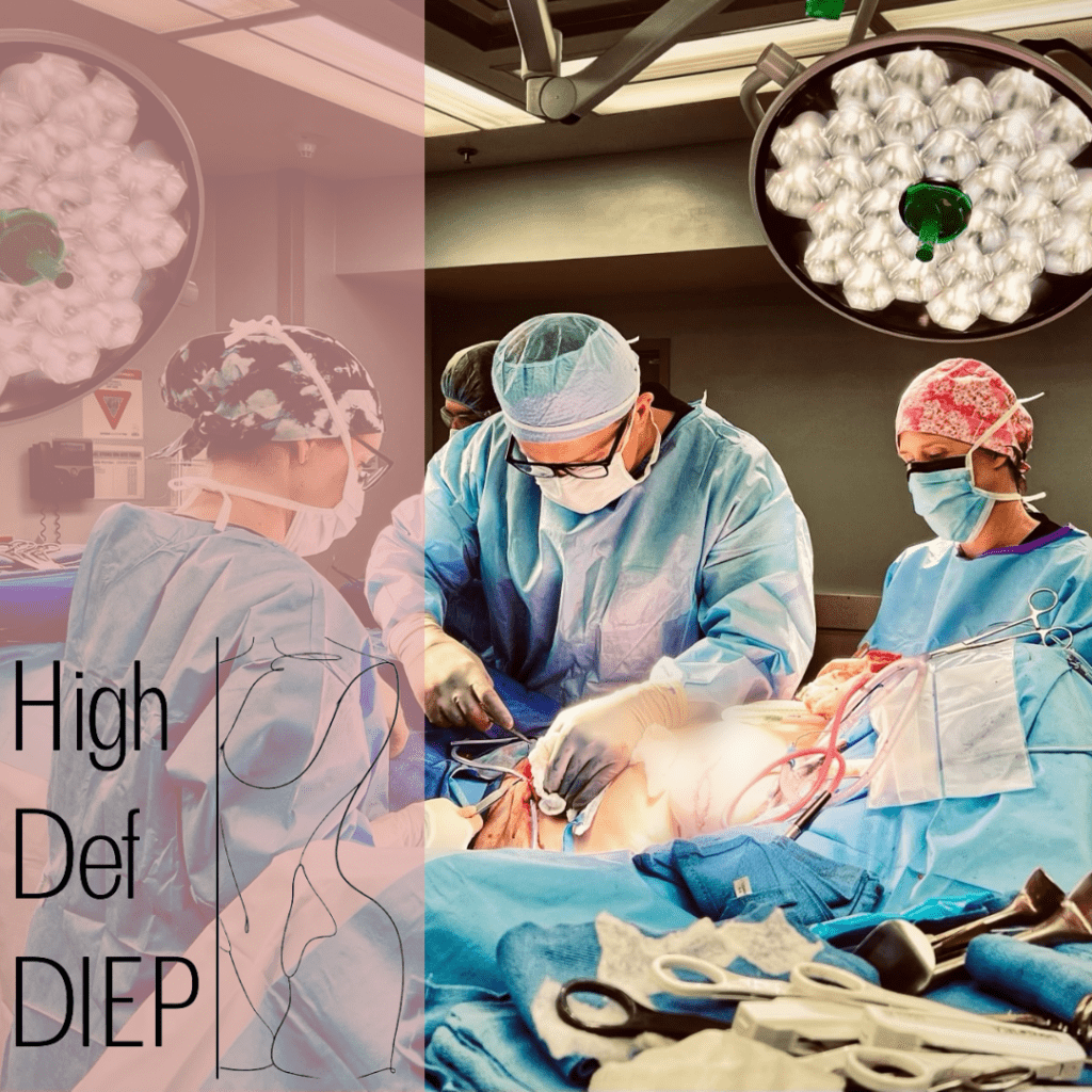 High Definition DIEP Flap Before & After Photos - PRMA